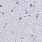 SERPINA3 Antibody in Immunohistochemistry (Paraffin) (IHC (P))