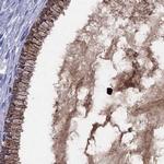 SERPINA3 Antibody in Immunohistochemistry (Paraffin) (IHC (P))