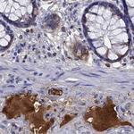 SERPINA3 Antibody in Immunohistochemistry (Paraffin) (IHC (P))