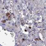 SERPINA3 Antibody in Immunohistochemistry (Paraffin) (IHC (P))