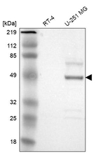 SERPINA3 Antibody in Western Blot (WB)
