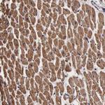 PSMA3 Antibody in Immunohistochemistry (Paraffin) (IHC (P))