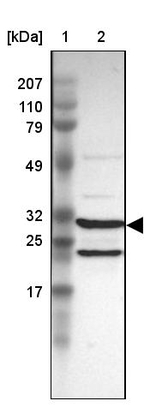 PSMA3 Antibody in Western Blot (WB)