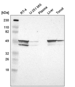 hnRNP H2 Antibody in Western Blot (WB)