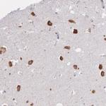 CTAGE5 Antibody in Immunohistochemistry (Paraffin) (IHC (P))