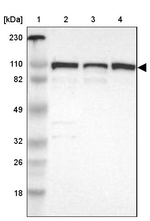 CTAGE5 Antibody in Western Blot (WB)