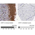 STAT1 Antibody in Immunohistochemistry (Paraffin) (IHC (P))
