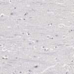 TYRP1 Antibody in Immunohistochemistry (Paraffin) (IHC (P))