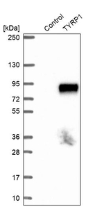 TYRP1 Antibody in Western Blot (WB)