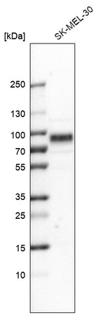 TYRP1 Antibody in Western Blot (WB)