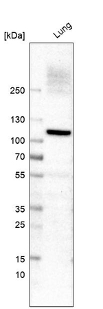 AOC3 Antibody in Western Blot (WB)