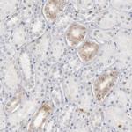 STAT1 Antibody in Immunohistochemistry (Paraffin) (IHC (P))