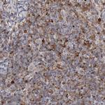 STAT1 Antibody in Immunohistochemistry (Paraffin) (IHC (P))