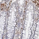 STAT1 Antibody in Immunohistochemistry (Paraffin) (IHC (P))