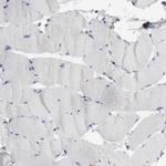 STAT1 Antibody in Immunohistochemistry (Paraffin) (IHC (P))