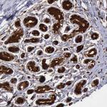 PDCD4 Antibody in Immunohistochemistry (Paraffin) (IHC (P))