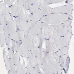 PDCD4 Antibody in Immunohistochemistry (Paraffin) (IHC (P))