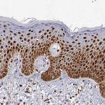 PDCD4 Antibody in Immunohistochemistry (Paraffin) (IHC (P))