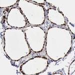 PDCD4 Antibody in Immunohistochemistry (Paraffin) (IHC (P))