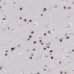 SATB2 Antibody in Immunohistochemistry (Paraffin) (IHC (P))