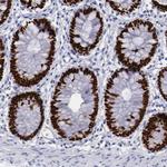 SATB2 Antibody in Immunohistochemistry (Paraffin) (IHC (P))