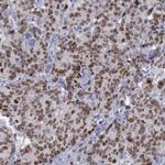SATB2 Antibody in Immunohistochemistry (Paraffin) (IHC (P))