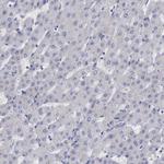 SATB2 Antibody in Immunohistochemistry (Paraffin) (IHC (P))