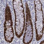 SATB2 Antibody in Immunohistochemistry (Paraffin) (IHC (P))