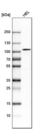 SATB2 Antibody in Western Blot (WB)