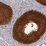 ETK Antibody in Immunohistochemistry (Paraffin) (IHC (P))