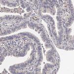 ETK Polyclonal Antibody