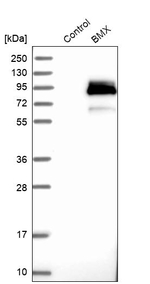ETK Antibody in Western Blot (WB)