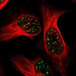 BRD1 Antibody in Immunocytochemistry (ICC/IF)