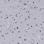 BRD1 Antibody in Immunohistochemistry (Paraffin) (IHC (P))