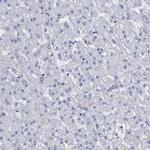 BRD1 Antibody in Immunohistochemistry (Paraffin) (IHC (P))