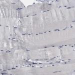 BRD1 Antibody in Immunohistochemistry (Paraffin) (IHC (P))