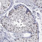 BRD1 Antibody in Immunohistochemistry (Paraffin) (IHC (P))