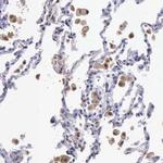 Thymidine Phosphorylase Antibody in Immunohistochemistry (Paraffin) (IHC (P))