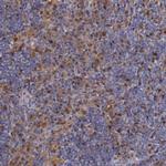 Thymidine Phosphorylase Antibody in Immunohistochemistry (Paraffin) (IHC (P))