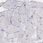 Thymidine Phosphorylase Antibody in Immunohistochemistry (Paraffin) (IHC (P))