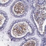 Thymidine Phosphorylase Polyclonal Antibody