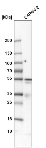 Thymidine Phosphorylase Antibody in Western Blot (WB)