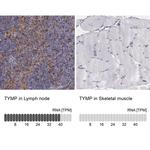 Thymidine Phosphorylase Antibody