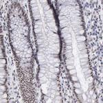 TAF1 Antibody in Immunohistochemistry (Paraffin) (IHC (P))