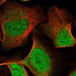 Apolipoprotein L2 Polyclonal Antibody