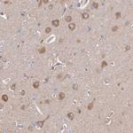 Apolipoprotein L2 Antibody in Immunohistochemistry (Paraffin) (IHC (P))