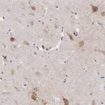 Apolipoprotein L2 Antibody in Immunohistochemistry (Paraffin) (IHC (P))