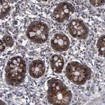 CrkL Polyclonal Antibody