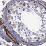 Filamin A Antibody in Immunohistochemistry (Paraffin) (IHC (P))