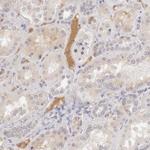 Complement Factor I Antibody in Immunohistochemistry (Paraffin) (IHC (P))